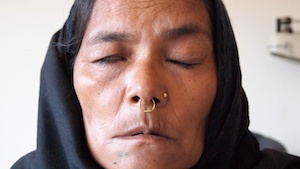 Acupuncture Case Study Acupuncture Case Study