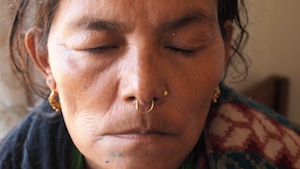 Acupuncture Case Study Acupuncture Case Study