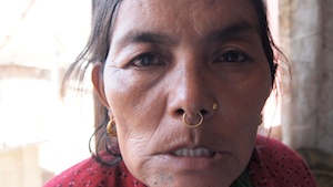 Acupuncture Case Study Acupuncture Case Study